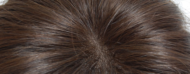 人毛ヘアピース 分け目部分